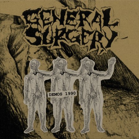 General Surgery - Demo 1990